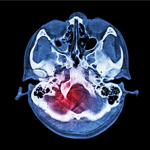 brain_scan5.jpg